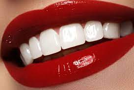 سفید کردن دندان ها توسط دندانپزشکی