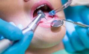 دندانپزشکی زیبایی و ترمیمی+جراحی زیبایی دندان