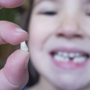 دندان کودکان