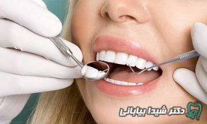 کامپوزیت دندان کلینیک شیدا بیابانی