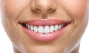 فلوراید تراپی دندان