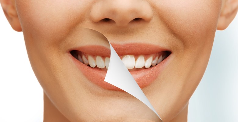 دندانپزشکی زیبایی و درمانی چه تفاوتی دارند