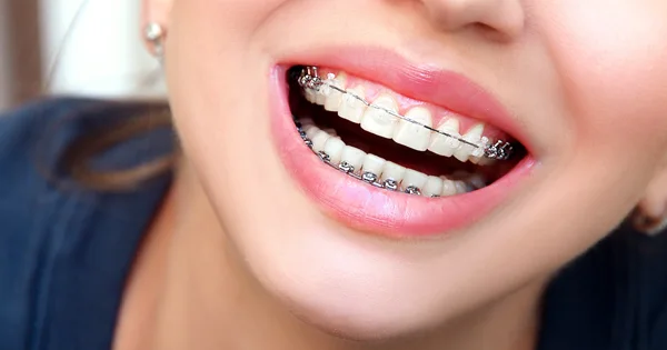 سن ارتودنسی دندان چند سال است ؟