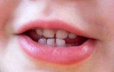 دندان کودکان و اهمیت آن | فیلم دندانپزشکی