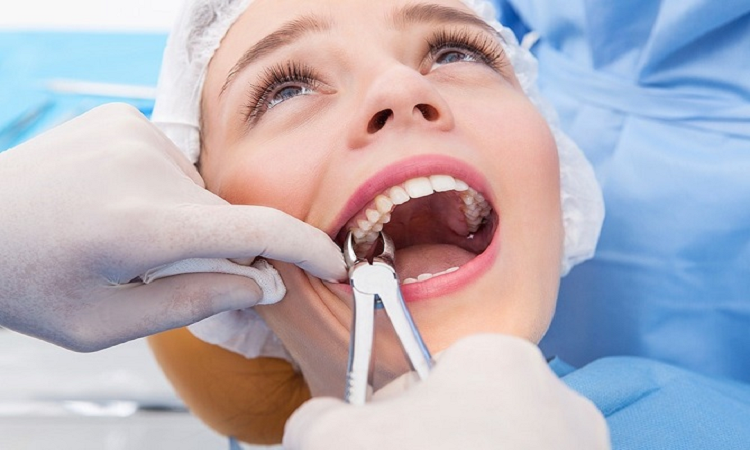 5 نوع جراحی دندان