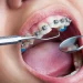 ارتودنسی دندان در چه زمانی مناسب است؟