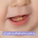 دلایل زرد شدن دندان کودکان