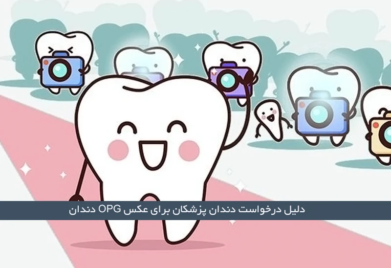 دلیل درخواست دندان پزشکان برای عکس OPG دندان