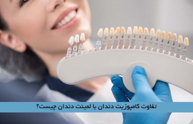 تفاوت کامپوزیت دندان با لمینت دندان چیست؟
