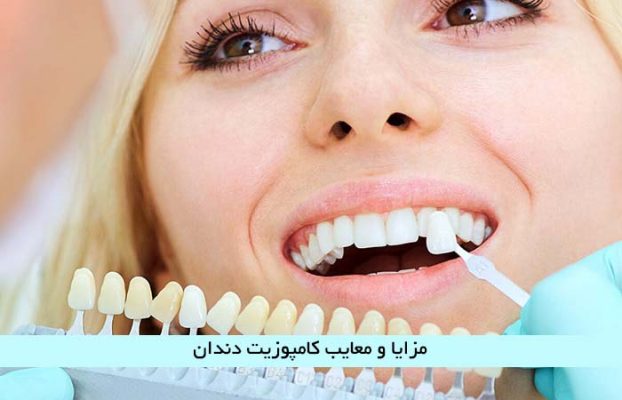 مزایا و معایب کامپوزیت دندان که دندان پزشکان به شما نمی گویند
