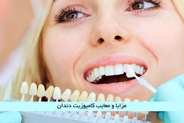 مزایا و معایب کامپوزیت دندان که دندان پزشکان به شما نمی گویند