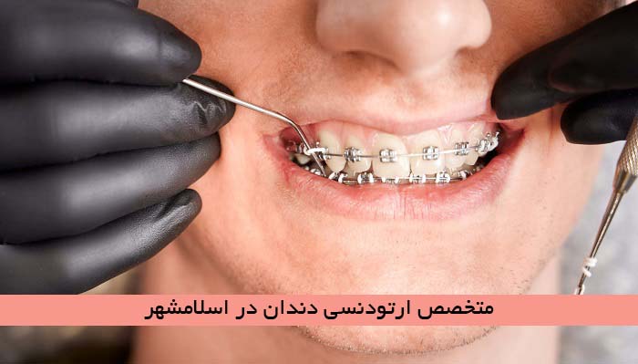 متخصص ارتودنسی دندان در اسلامشهر