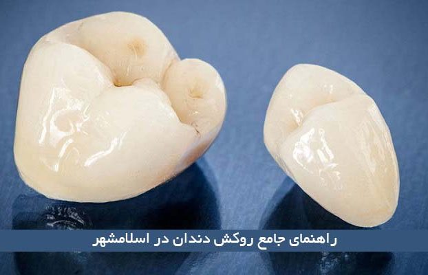 راهنمای جامع روکش دندان در اسلامشهر
