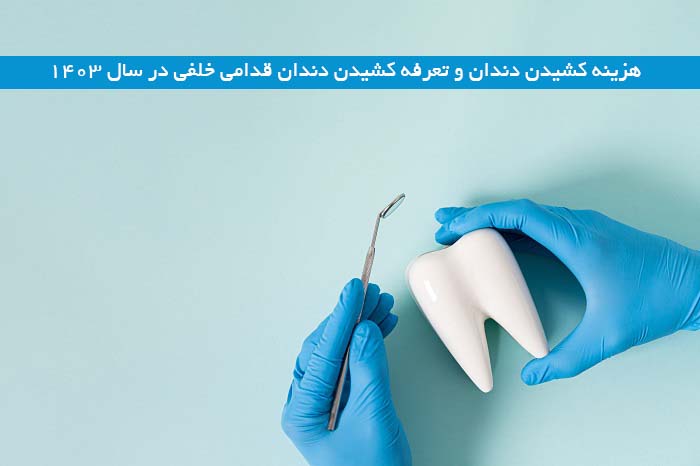 هزینه کشیدن دندان و تعرفه کشیدن دندان قدامی خلفی در سال 1403