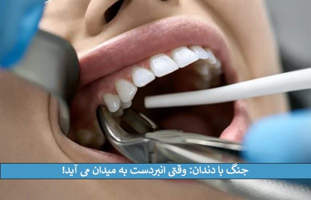 جنگ با دندان: وقتی انبردست به میدان می ‌آید!