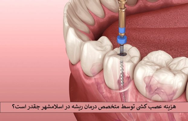 هزینه عصب‌ کشی توسط متخصص درمان ریشه در اسلامشهر چقدر است؟