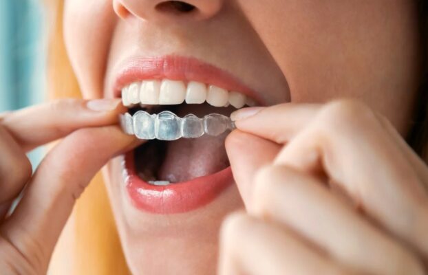 ارتودنسی نامرئی واقعا موثر است؟