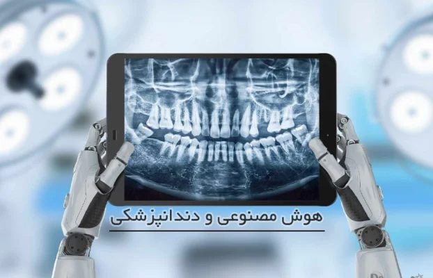 هوش مصنوعی در تشخیص پوسیدگی دندان