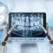 هوش مصنوعی در تشخیص پوسیدگی دندان