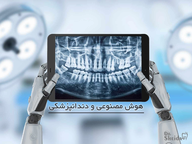 هوش مصنوعی در تشخیص پوسیدگی دندان